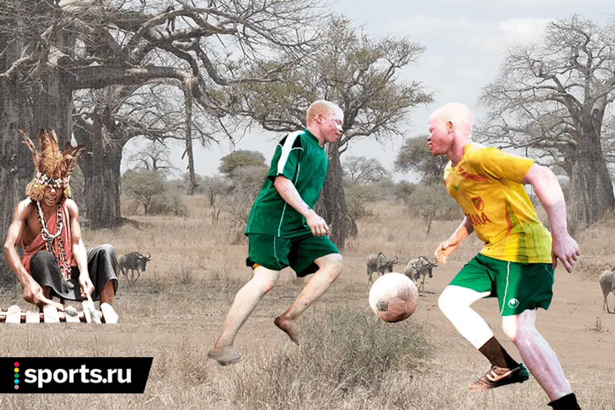 «На людей не должны охотиться, как на животных». В Танзании убивают и калечат альбиносов – бороться им помогает футбол