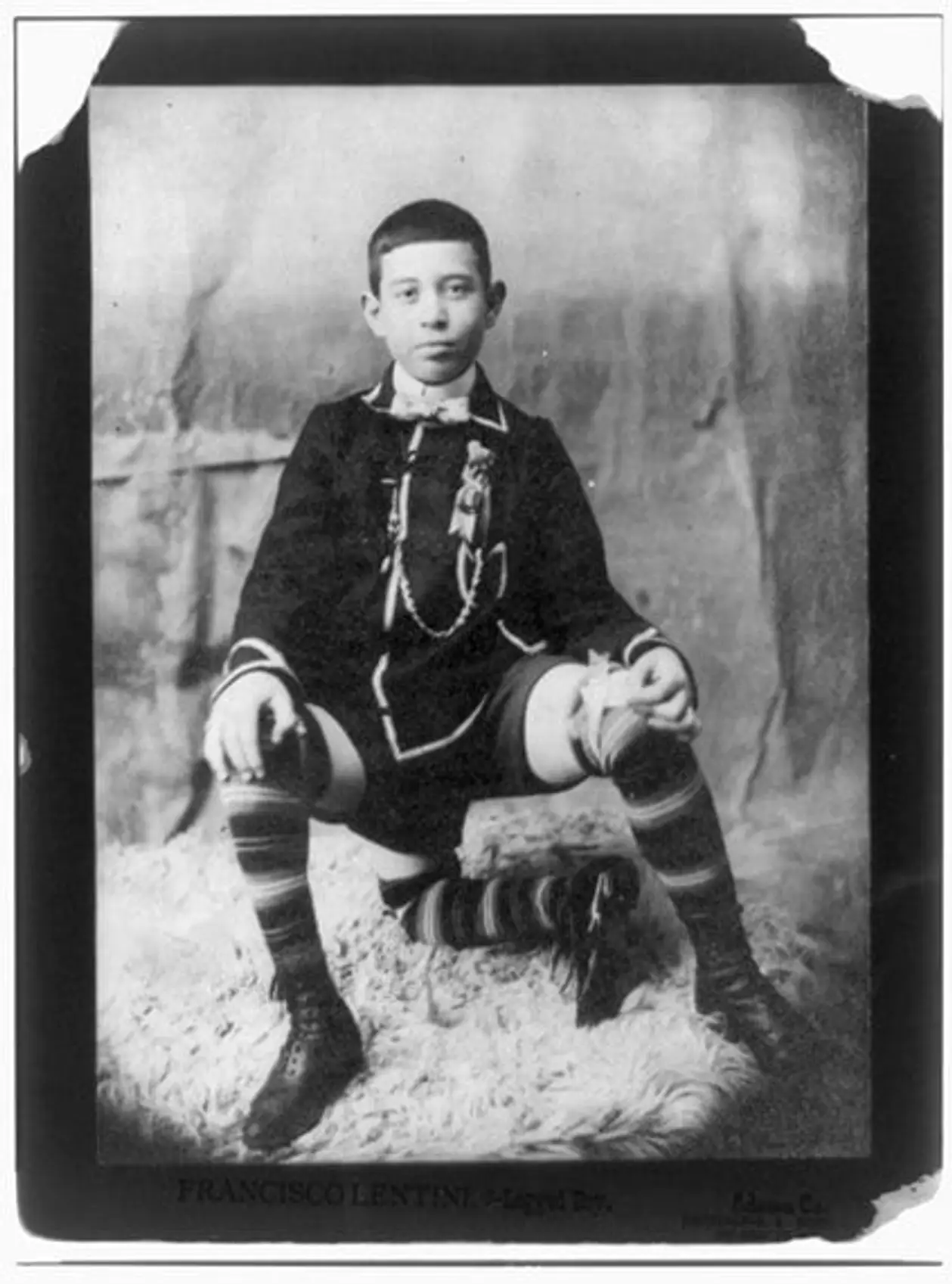 Циркач, который прославился футбольной чеканкой. Он родился с 3 ногами и 16 пальцами, но был счастлив 