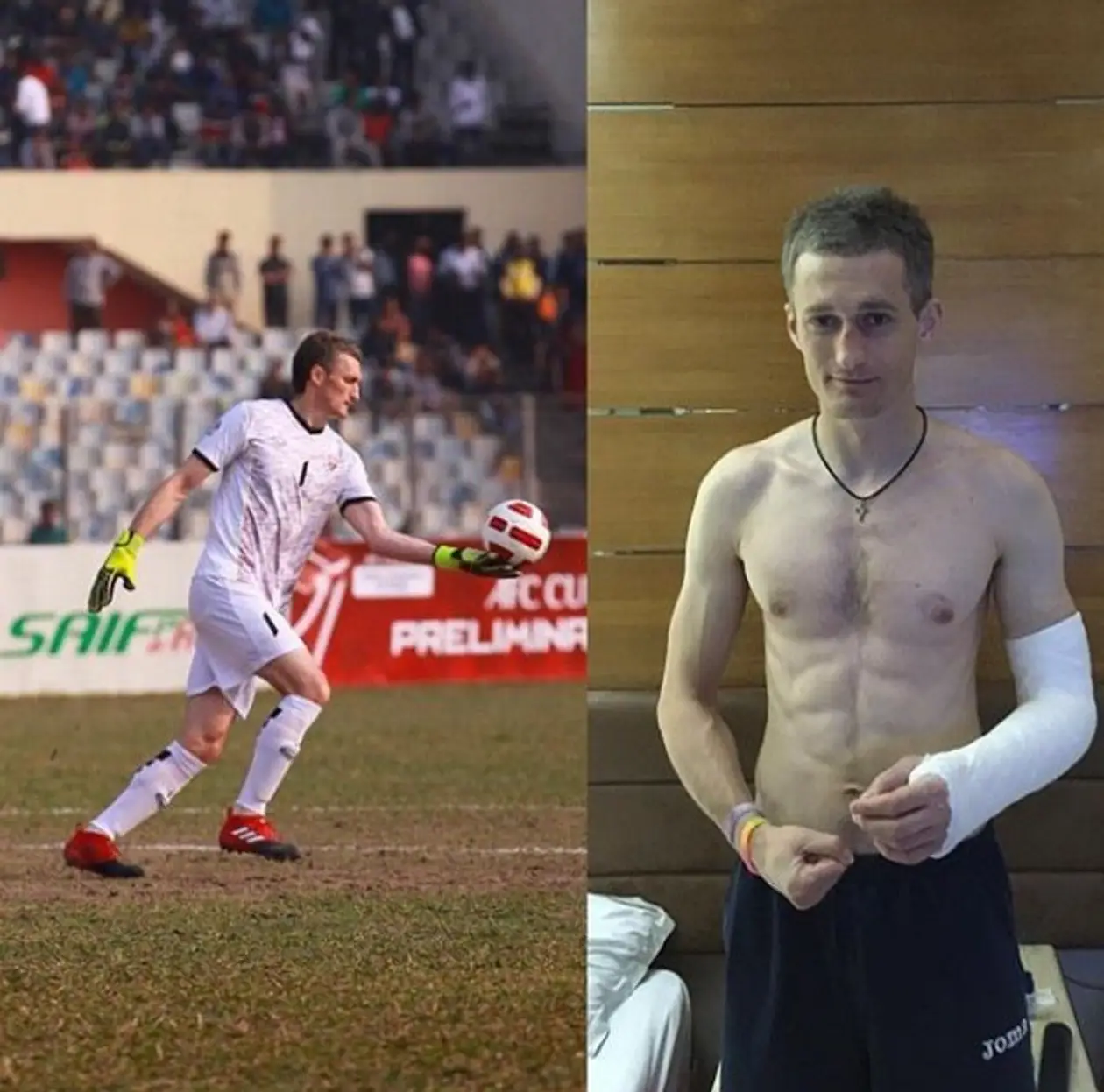 Белорус улетел на Мальдивы играть в футбол: в первом же матче травмировал руку, а затем стало еще хуже